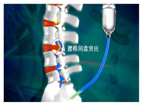 腰16.jpg